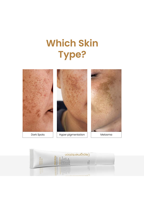 Melakey Azelaic Acid Radiance Cream for Pigmentation | Size: 20 gm