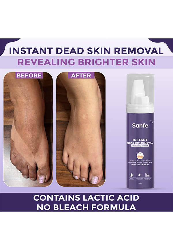 Instant Dead Skin Removal Exfoliating Mousse | Visibly Removes Tan, Exfoliation in Minutes | For Smooth & Bright Skin – thumbnail 4