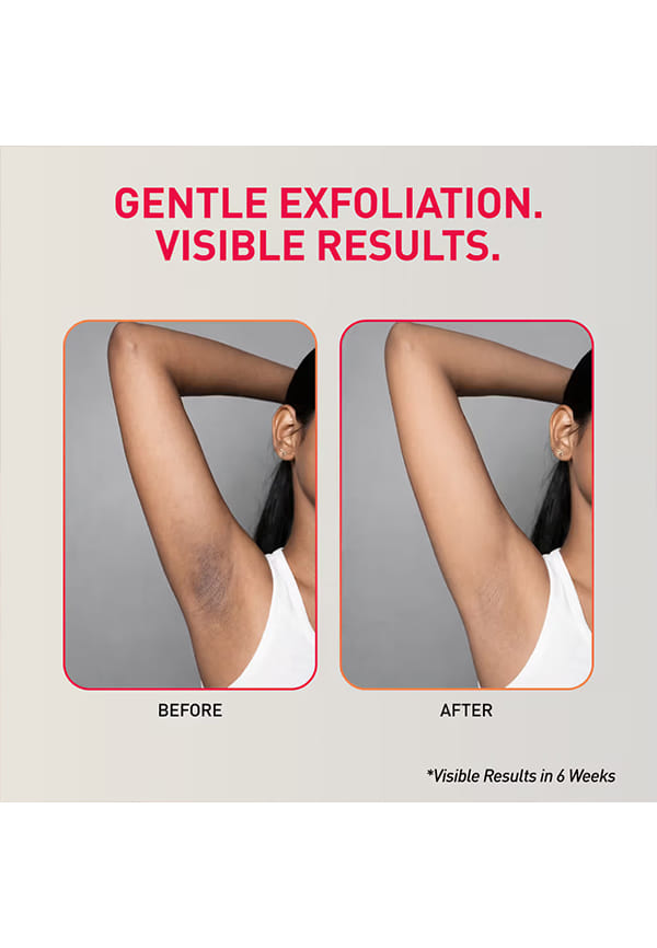 Depigmentation Underarm Mist – thumbnail 3