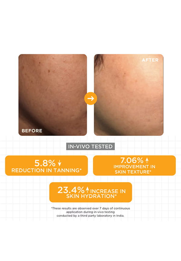 15% Vitamin C Glow Serum for Face & Neck – thumbnail 4