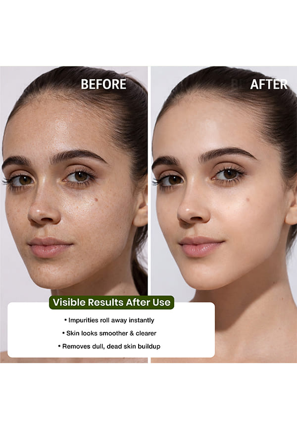Dead Skin Exfoliation Gel – thumbnail 4