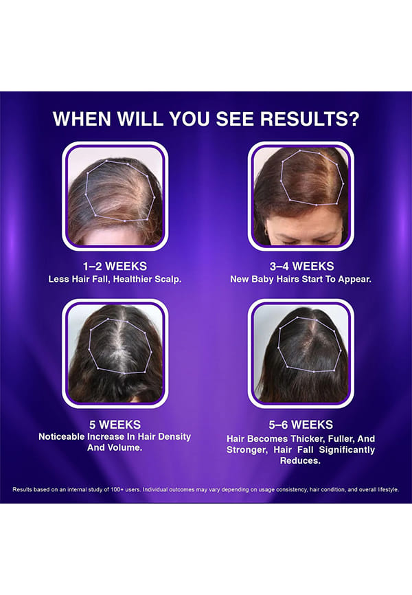 Advanced Hair Growth Serum – thumbnail 4