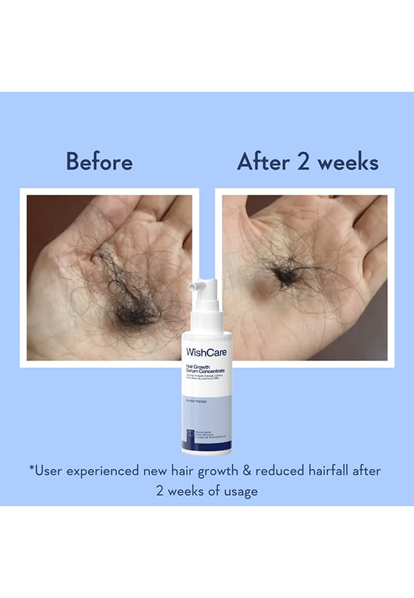 Hair Growth Serum Concentrate – thumbnail 4