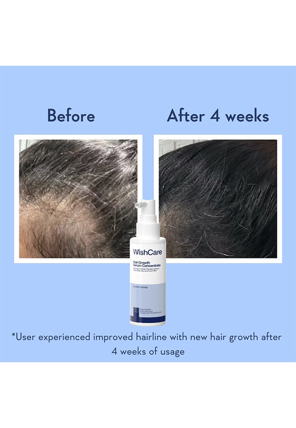 Hair Growth Serum Concentrate – thumbnail 5