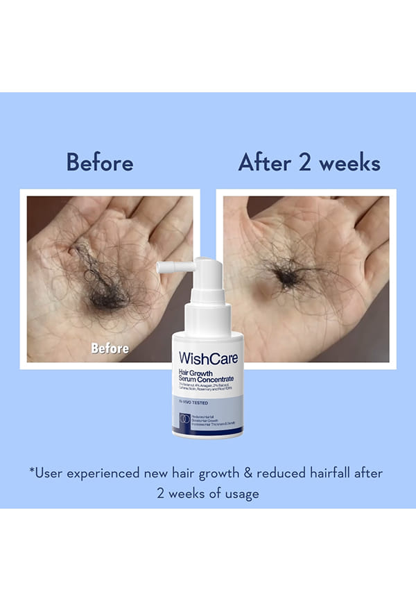 Hair Growth Serum Concentrate – thumbnail 4