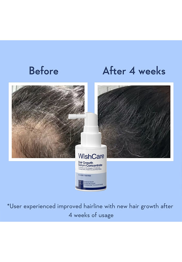 Hair Growth Serum Concentrate – thumbnail 5