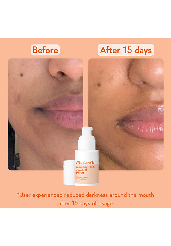 Super Bright C16 Vitamin C Face Serum – thumbnail 9
