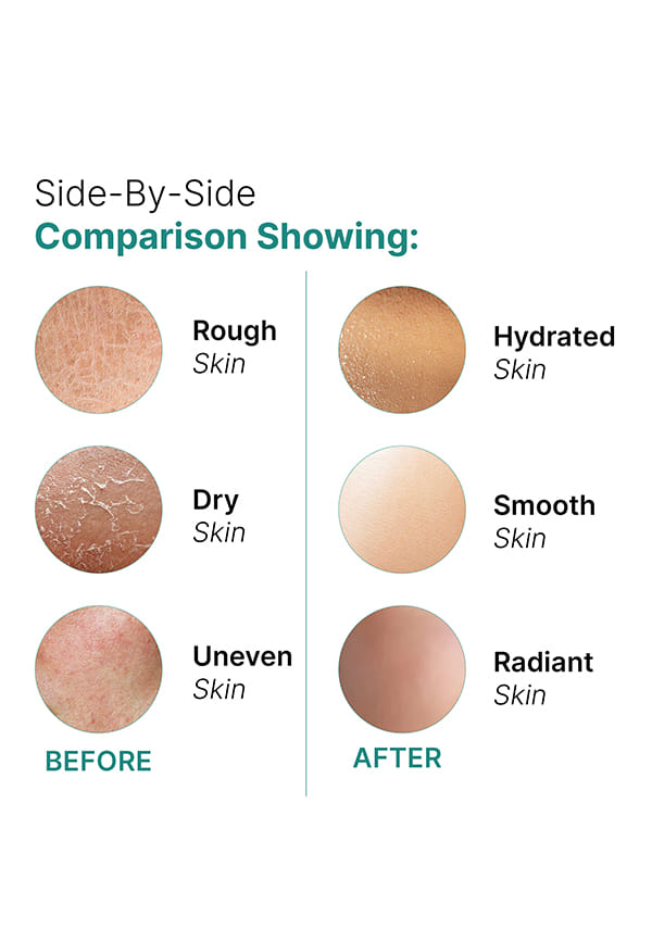 Skin Superfoods 72 hrs Advanced Hydrating Face Gel – thumbnail 5