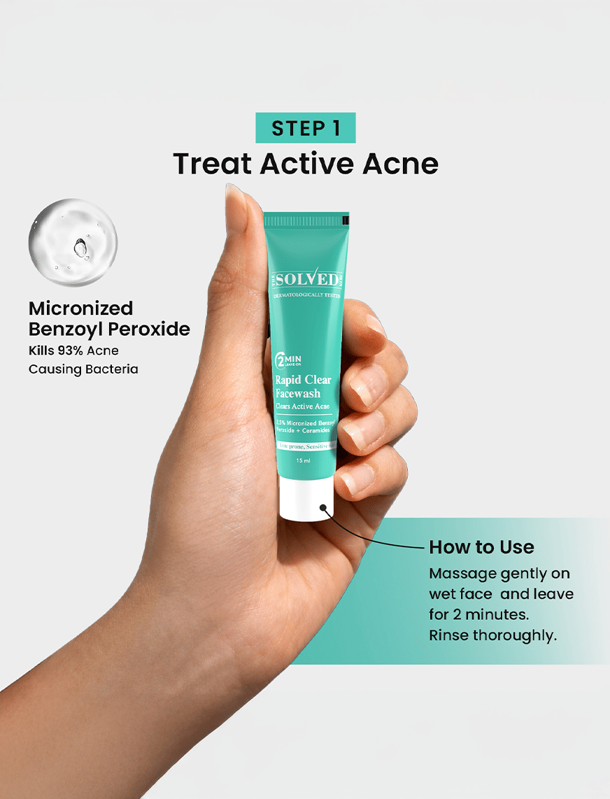 Solved Skin Acne Care Combo Kit – thumbnail 5