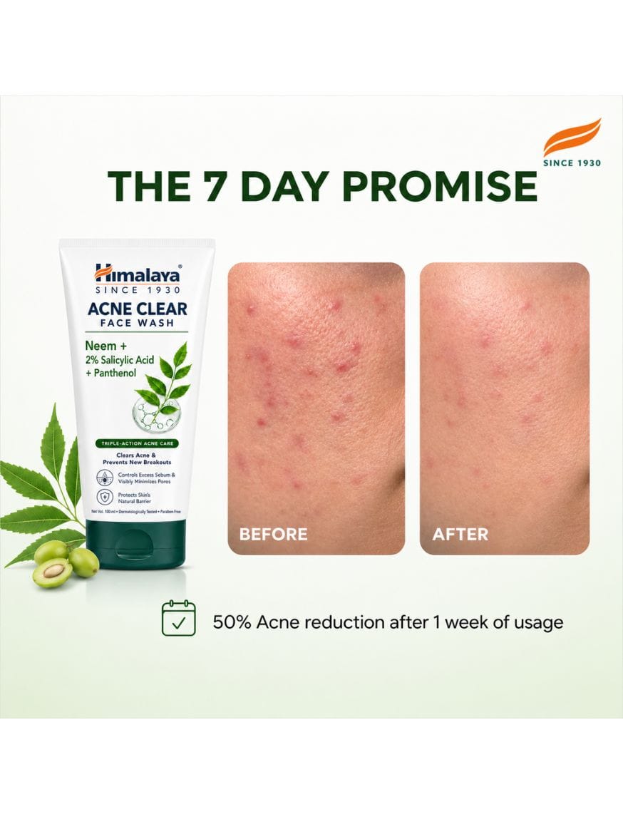 Acne Clear Face Wash With Neem – thumbnail 5