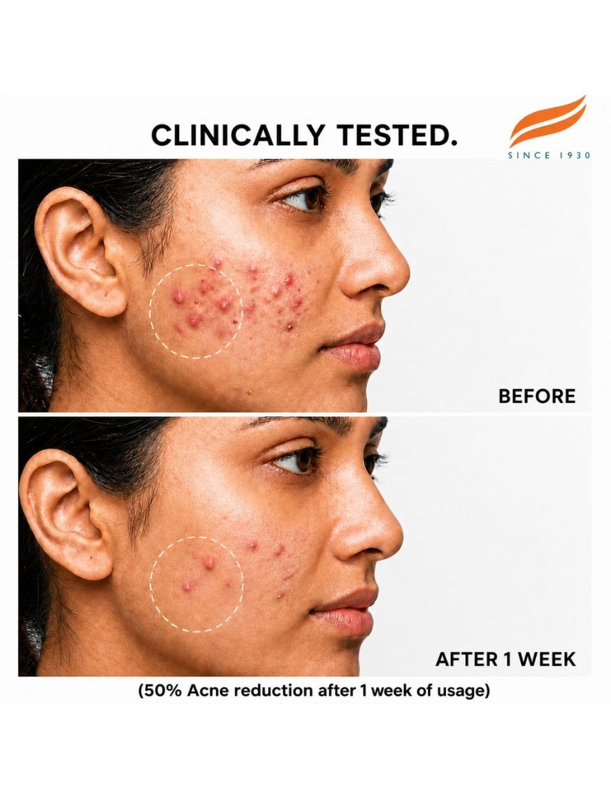 Clineva Acne Clear Face Wash – thumbnail 5